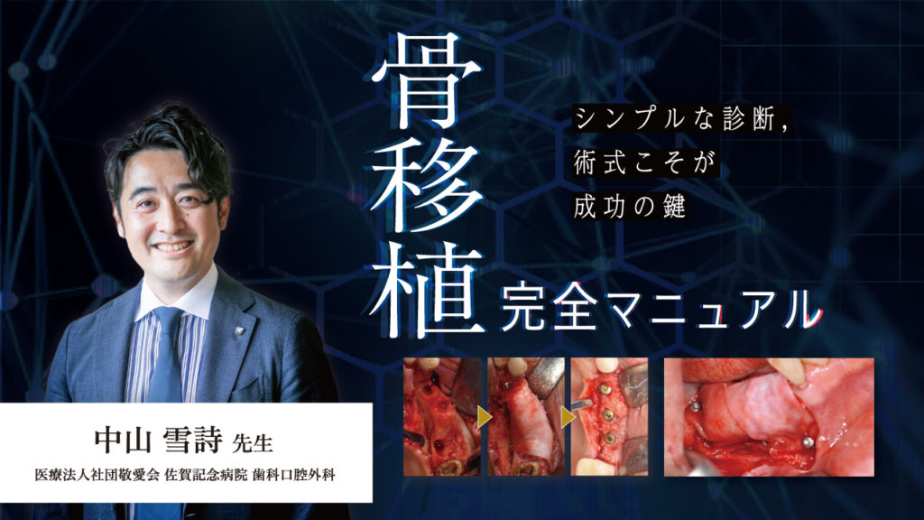 骨移植 完全マニュアル〜シンプルな診断、術式こそが成功の鍵〜