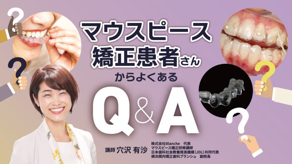 マウスピース矯正患者さんからよくあるQ&A