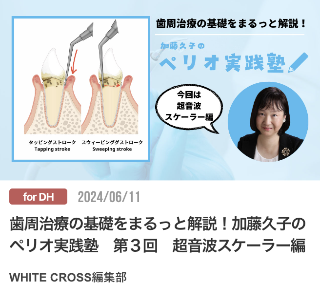 歯周治療の基礎をまるっと解説！加藤久子のペリオ実践塾　第３回　超音波スケーラー編