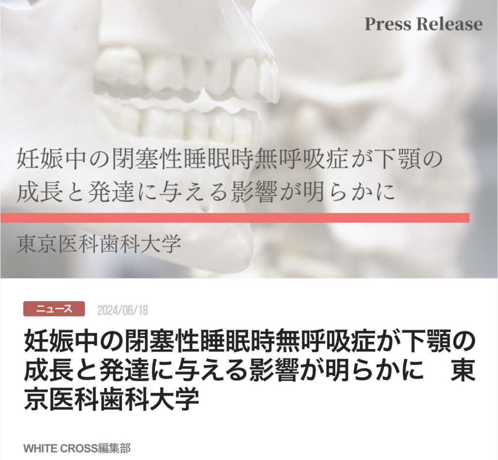 妊娠中の閉塞性睡眠時無呼吸症が下顎の成長と発達に与える影響が明らかに　東京医科歯科大学
