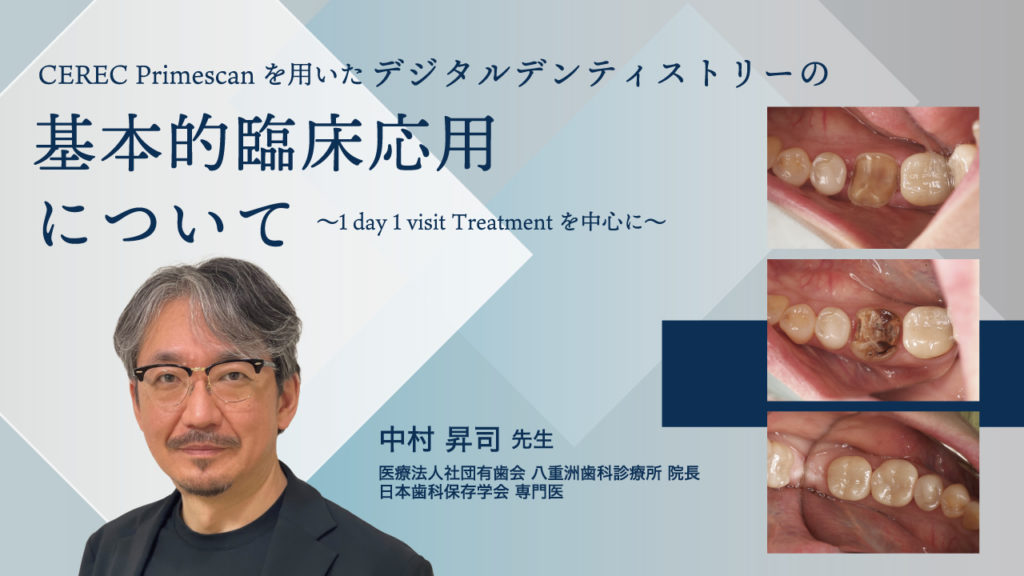 CEREC Primescanを用いたデジタルデンティストリーの基本的臨床応用について〜1 day 1 visit Treatmentを中心に〜