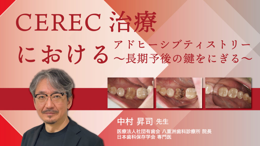 CEREC治療におけるアドヒーシブティストリー〜長期予後の鍵をにぎる〜