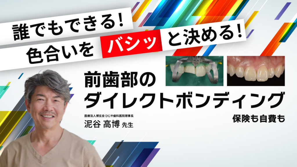 誰でもできる！色合いをバシッと決める！前歯部のダイレクトボンディング〜保険も自費も〜